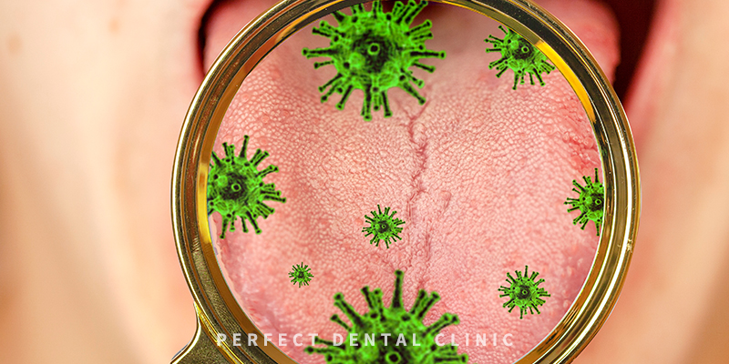 설태 생기는 이유와 없애는 방법 관련 이미지 3