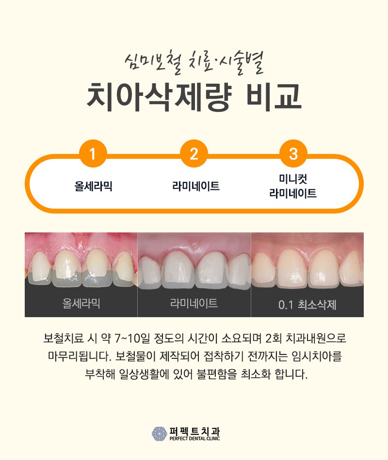 라미네이트 부작용 왜 나타나는 건가요? 관련 이미지 2