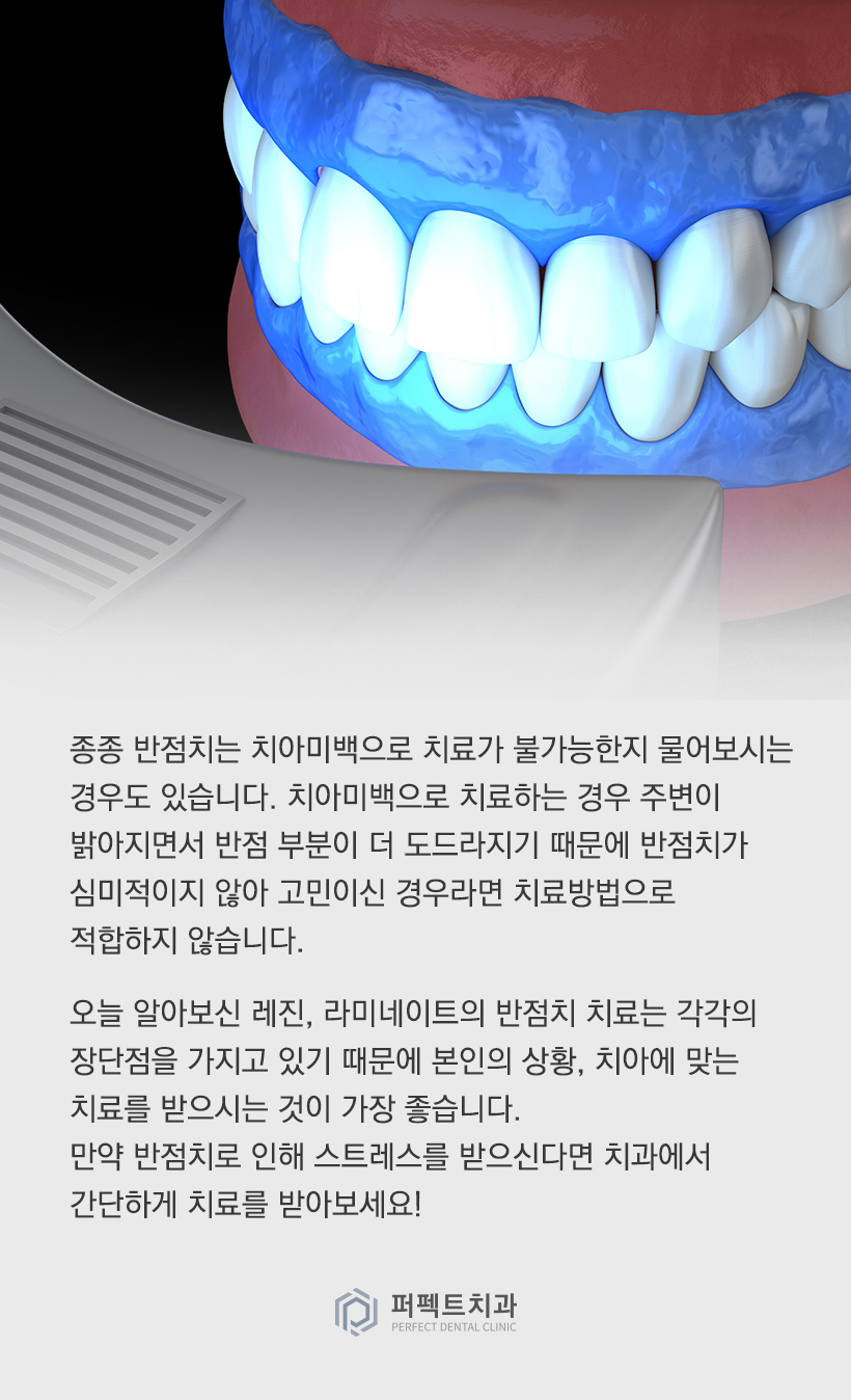 앞니 반점치는 어떻게 치료하나요? 관련 이미지 5
