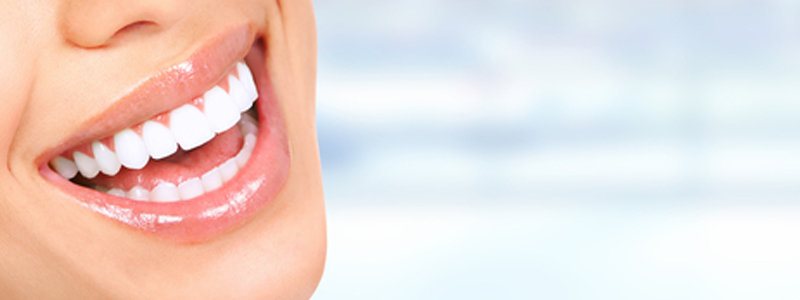 앞니라미네이트 치아삭제량 궁금해? 관련 이미지 2