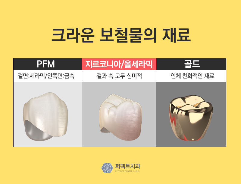 충치치료 치아크라운비용 관련 이미지 6