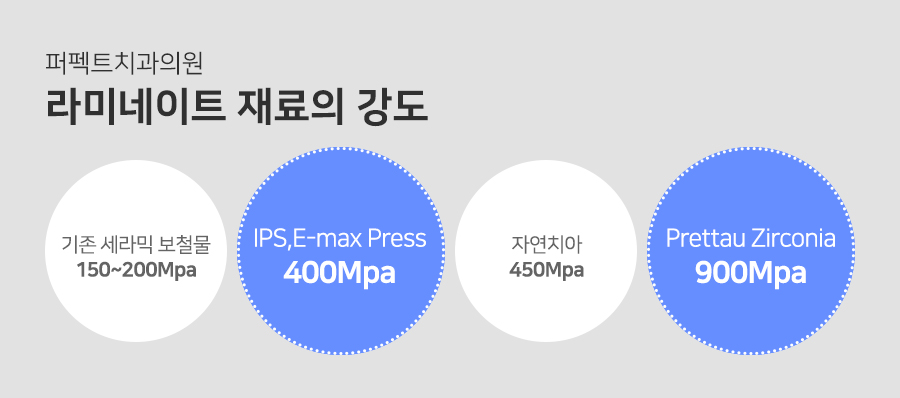 라미네이트 치료 시 참고사항은? 관련 이미지 7