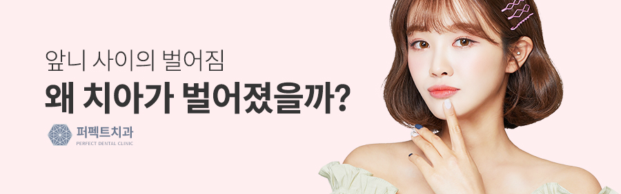 벌어진 앞니, 간단한 교정치료 관련 이미지 2