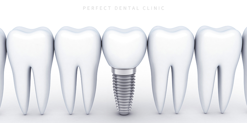 오스템임플란트 잘하는 선릉역 치과 관련 이미지 4
