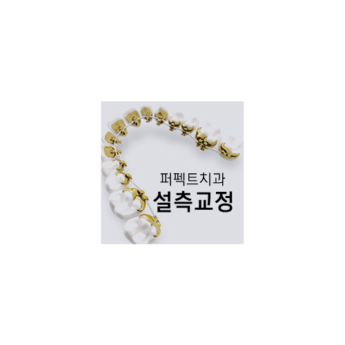 치아안쪽에 교정하는 설측교정! 관련 이미지 5