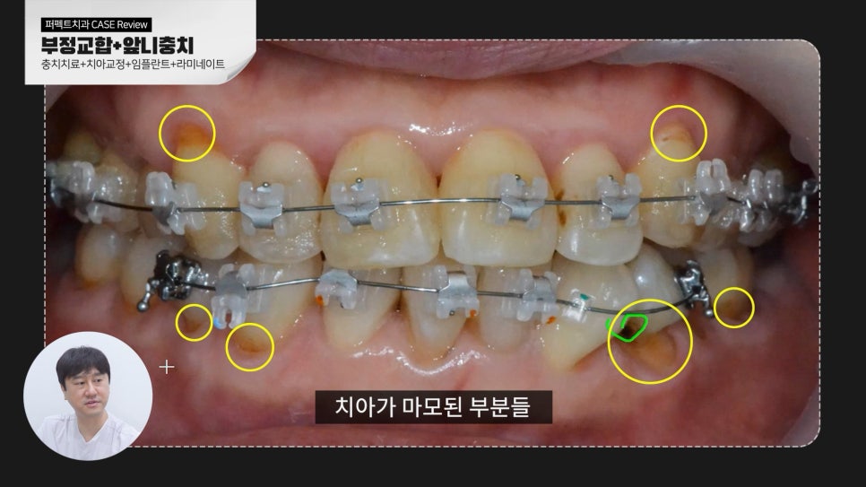 복합적인 치료가 필요한 케이스 리뷰 관련 이미지 6