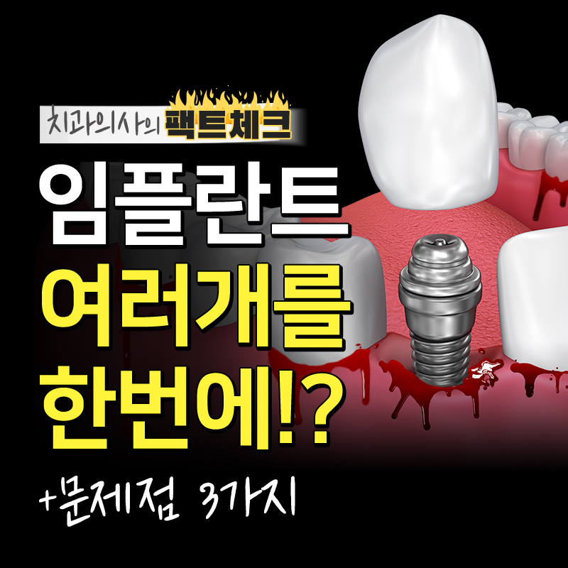 임플란트 발치 한번에 하게되면? 관련 이미지 1