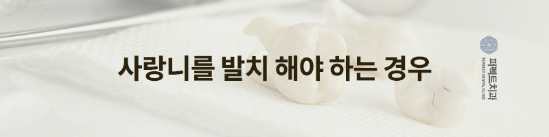 사랑니 발치 후 주의사항은? 관련 이미지 2