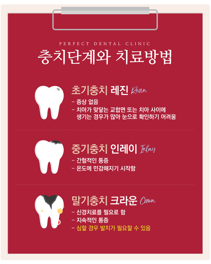 레진치료&충치치료 급한 사람들에게 좋은 소식! 관련 이미지 4