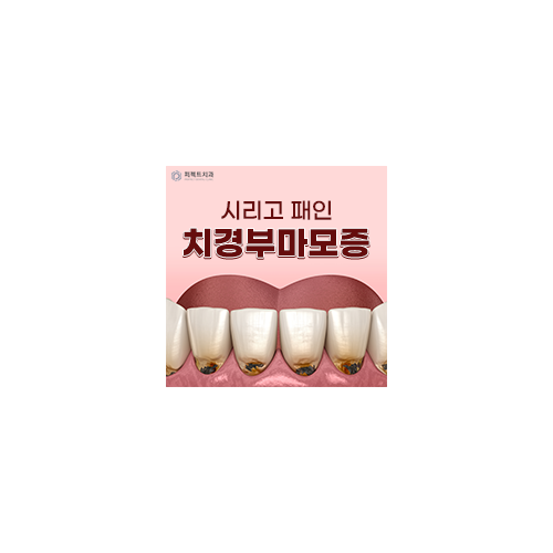 시린 이 치경부 마모증 비용 관련 이미지 5