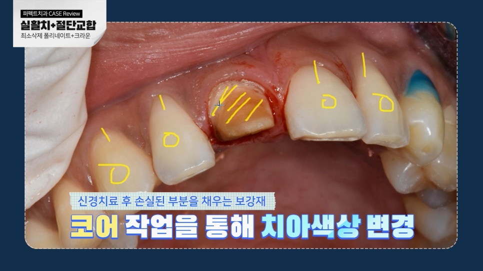 남자라미네이트, 더 오래 사용하려면? 관련 이미지 7
