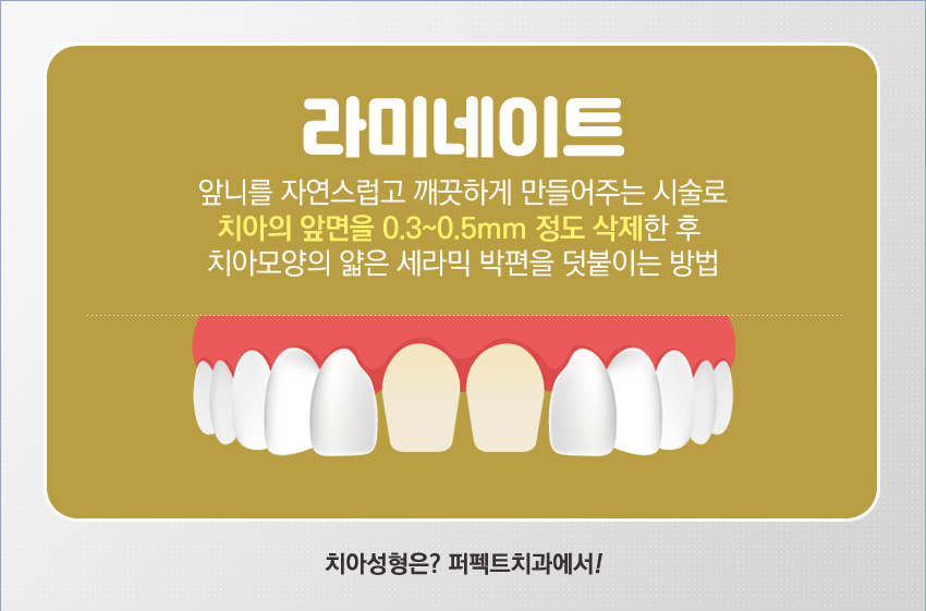 라미네이트비용이 궁금하다면?? 관련 이미지 1