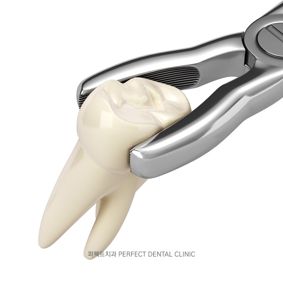 치아교정시 발치는 꼭 해야하나요? 관련 이미지 2