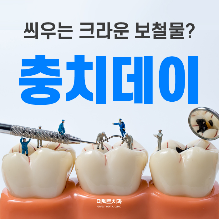 세라믹 인레이 충치치료 비용 관련 이미지 1