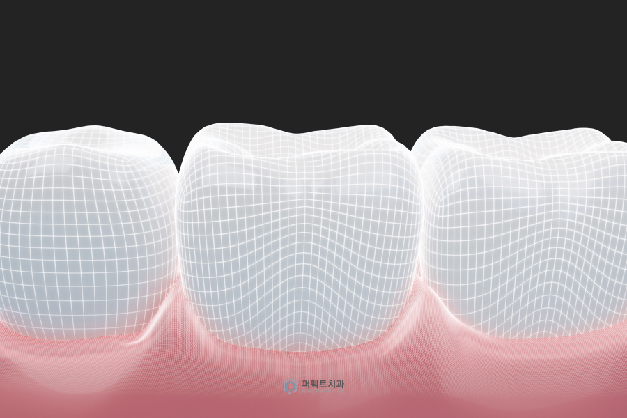 임플란트 관리｜임플란트 후 음식물이 끼는 이유는 관련 이미지 3