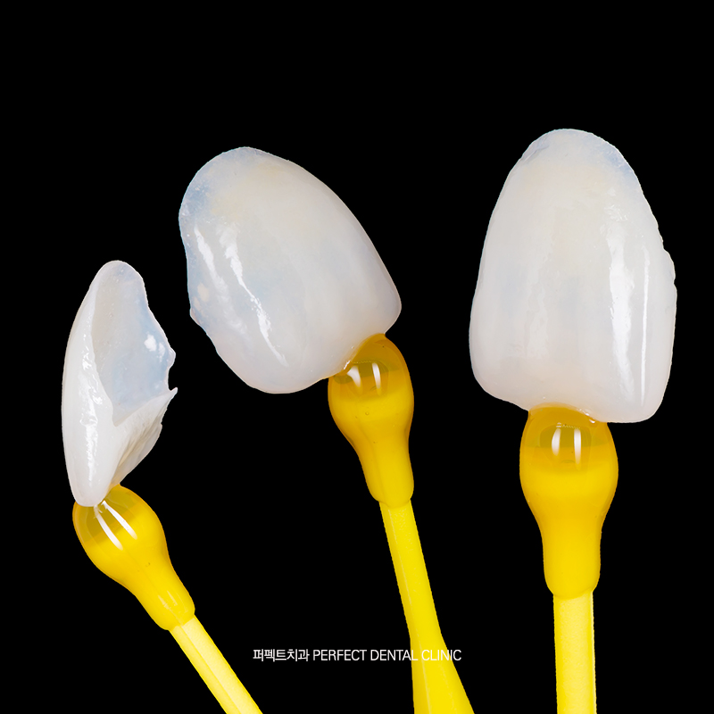 라미네이트 수명은 어떻게 되나요? 관련 이미지 2