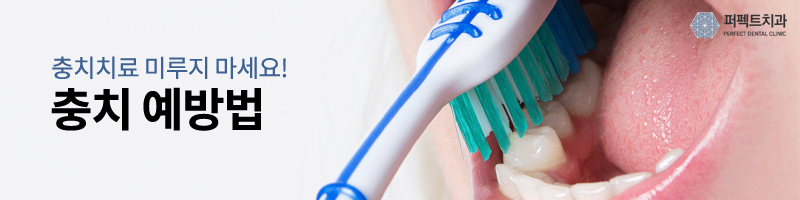 충치 없애는법, 충치DAY 진행중~! 관련 이미지 3