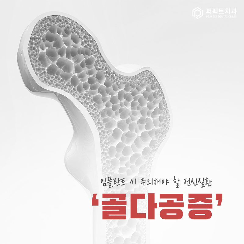 임플란트 시 전신질환 관련 주의사항과 부작용! 관련 이미지 3