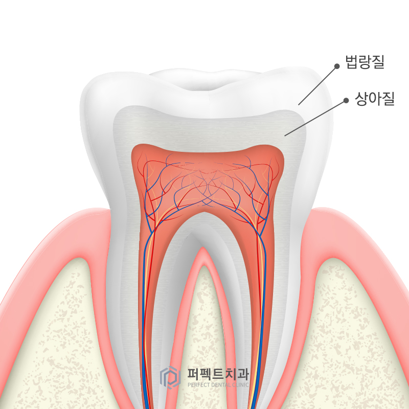 탈락한 라미네이트 재부착 가능할까요? 관련 이미지 3