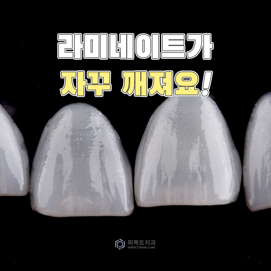 라미네이트가 자꾸 깨지는 이유는? 관련 이미지 1