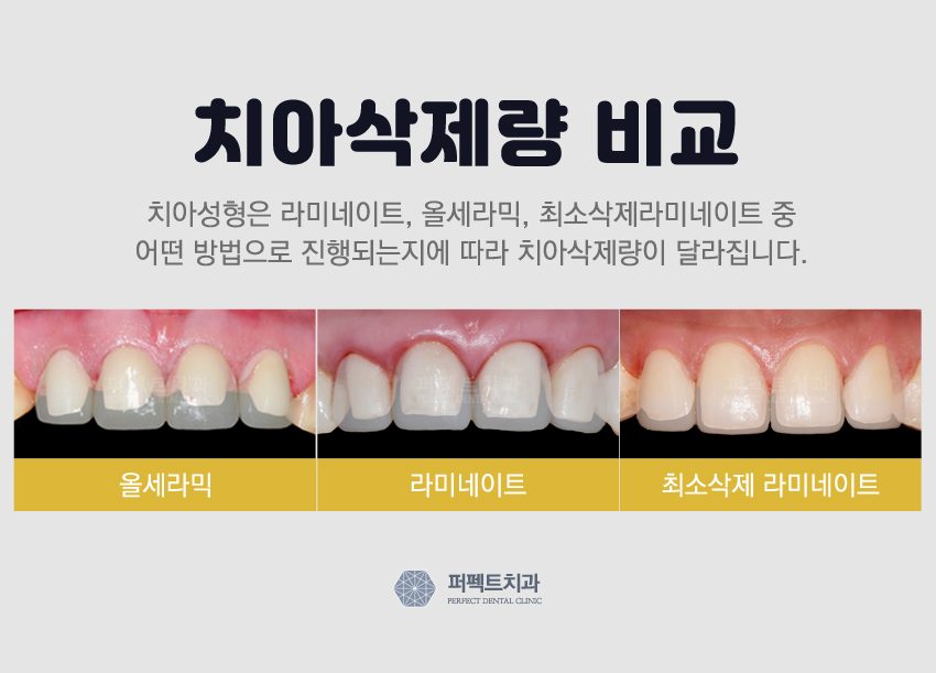 라미네이트비용이 궁금하다면?? 관련 이미지 3