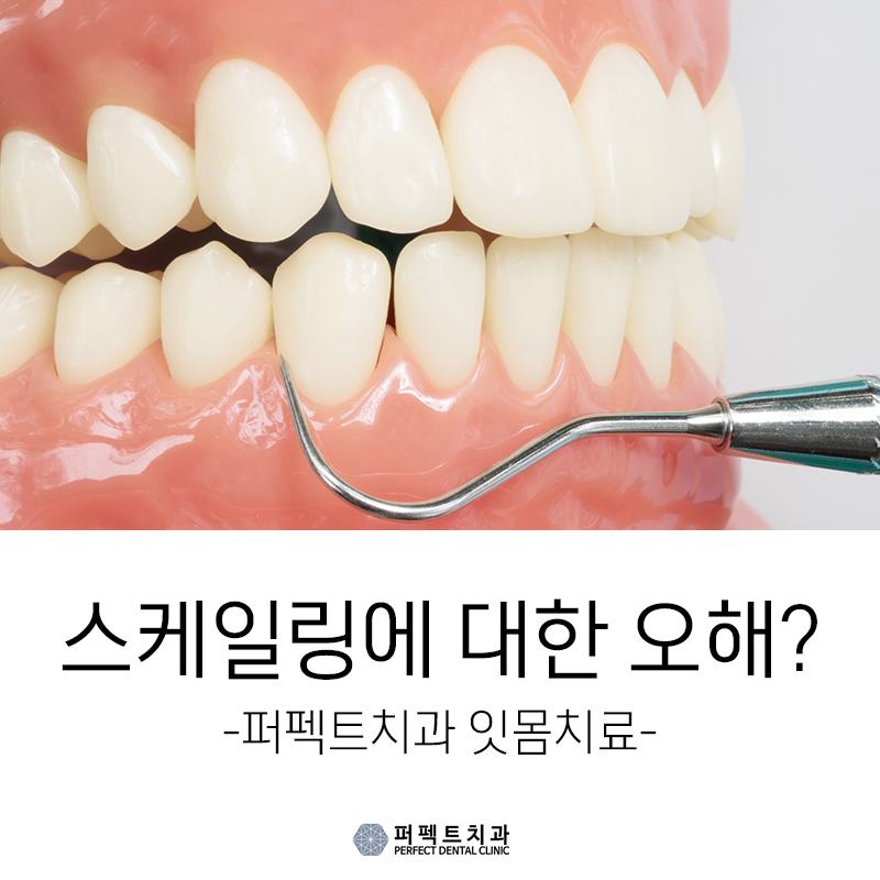 스케일링 의료보험 관련 이미지 1