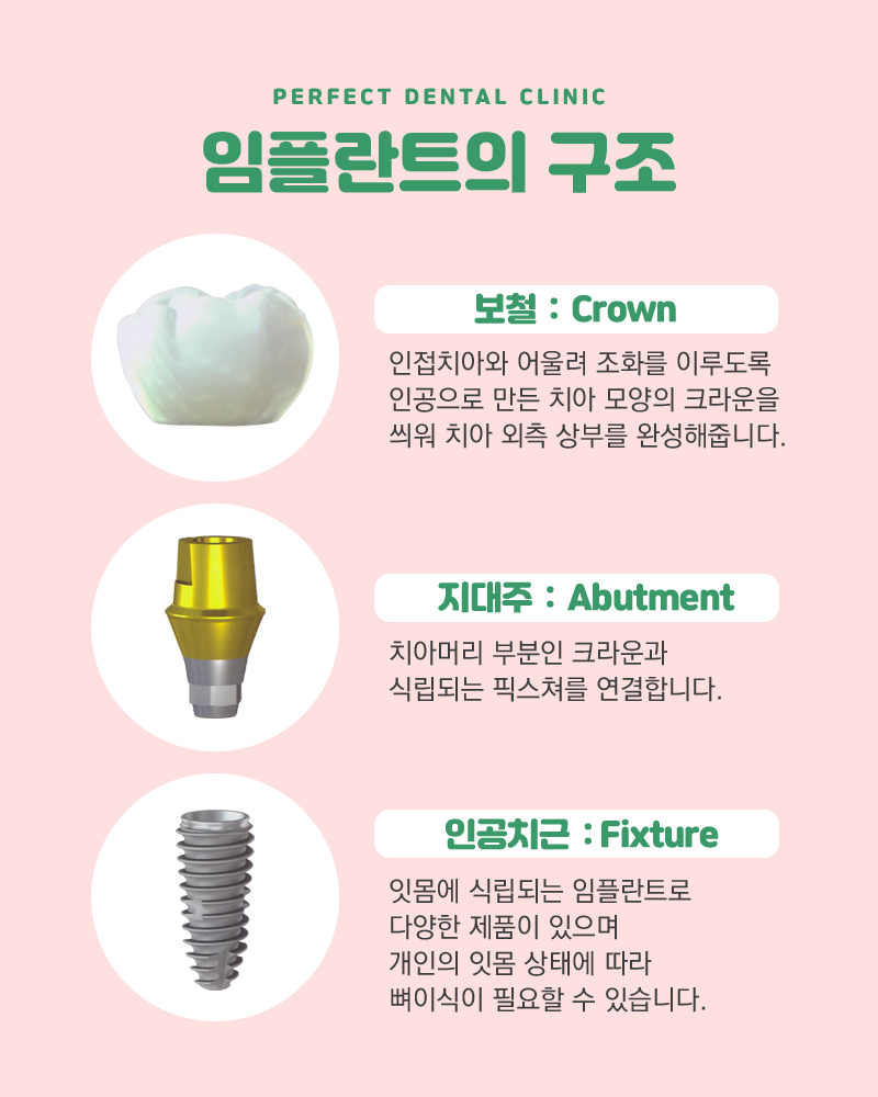 임플란트비용 부담 줄이자~ 관련 이미지 3