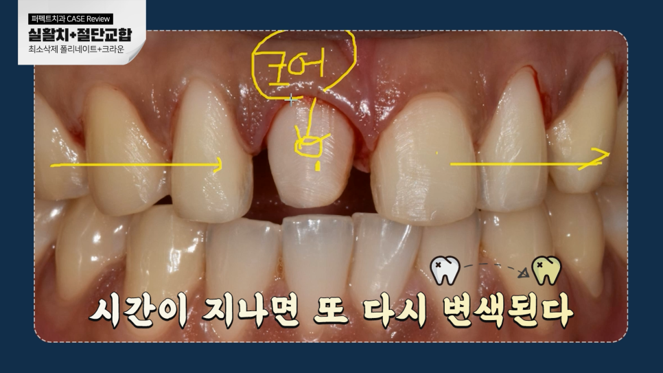 남자라미네이트, 더 오래 사용하려면? 관련 이미지 9