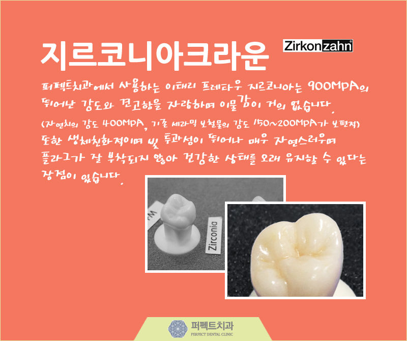 다시돌아온 지르코니아 크라운! 관련 이미지 4