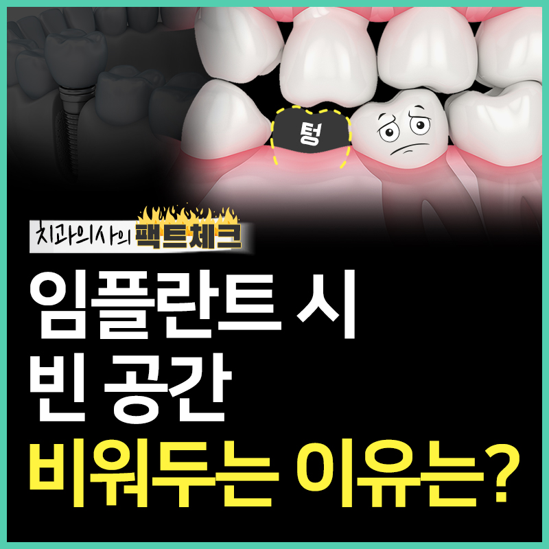어금니 임플란트 부작용, 미리예방! 관련 이미지 1