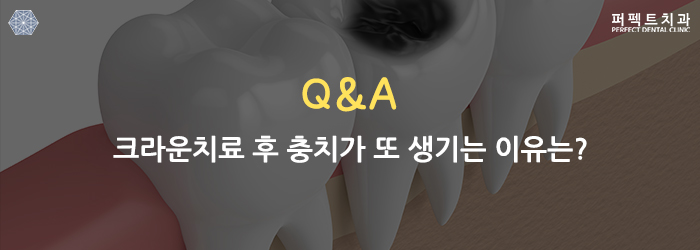 궁금했던 치과 Q&A 물어보세요! 관련 이미지 5