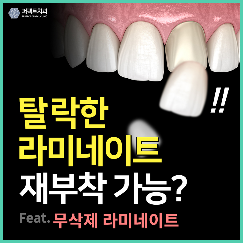 떨어진 라미네이트 재시술 가능? 관련 이미지 1