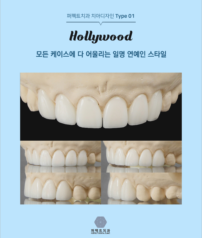 올세라믹 알아보고 있다면! 관련 이미지 5