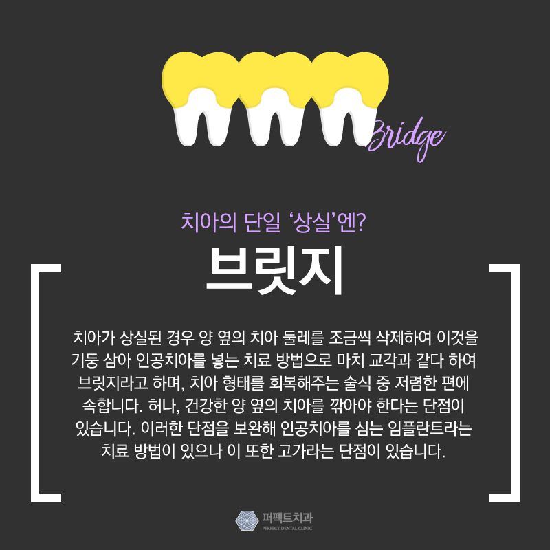 보철치료 종류와 비용 관련 이미지 5