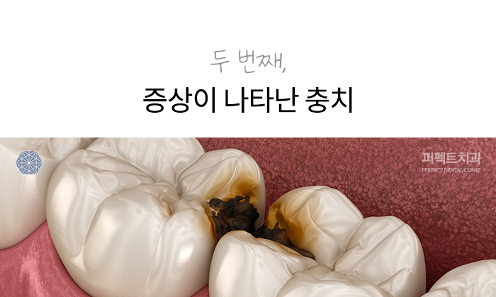 절대 무시하면 안 되는 치아증상 (치과치료꿀TIP!) 관련 이미지 3