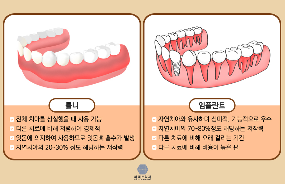 전체임플란트 고민되는데.. 관련 이미지 4