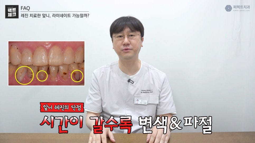 레진으로 치료받은 앞니도 라미네이트 가능한가요? 관련 이미지 2