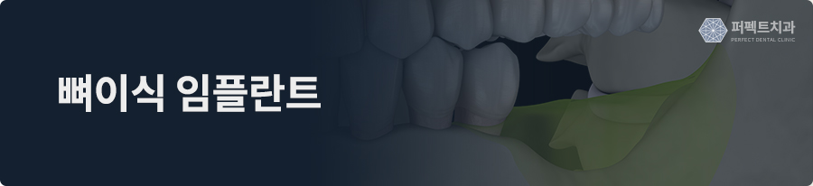 잇몸 상태가 안 좋은 50대, 뼈이식 임플란트 후 관련 이미지 1