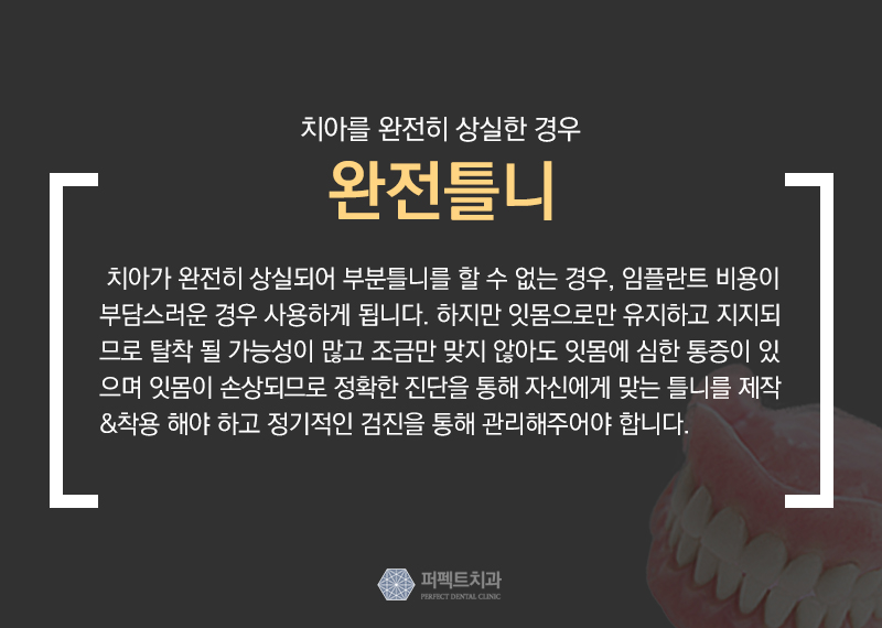 보철치료 종류와 비용 관련 이미지 8