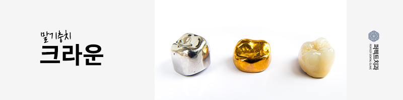 충치치료 레진 비용 얼마? 관련 이미지 4