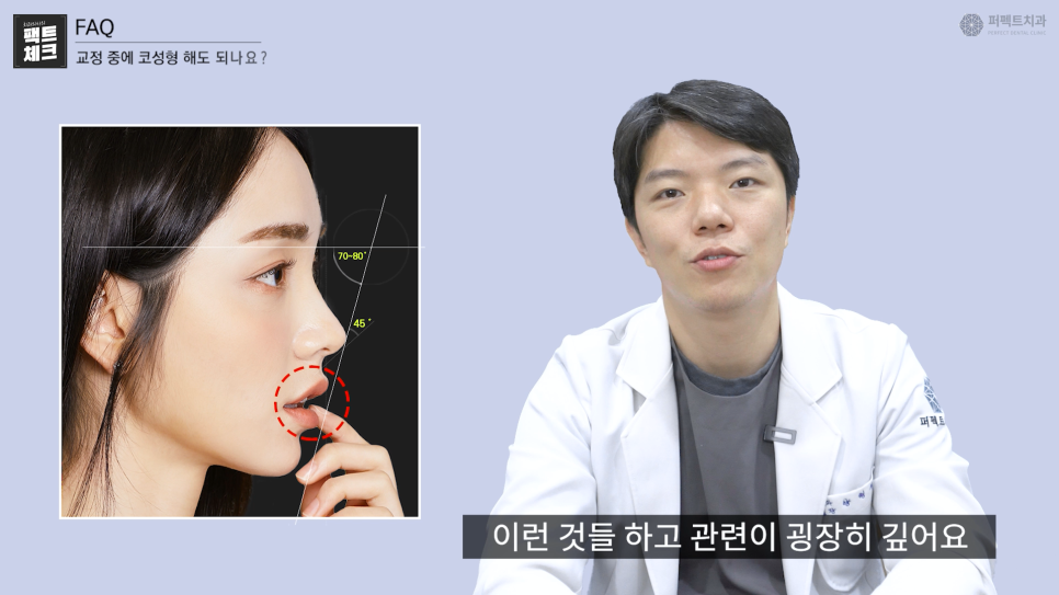 치아교정vs코성형 어떤 걸 먼저 해야 할까? 관련 이미지 2