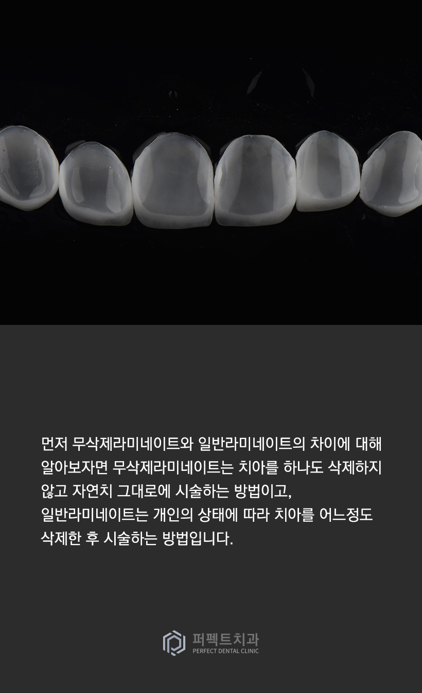 무삭제라미네이트 vs 일반라미네이트 수명에 차이가 있나요? 관련 이미지 1