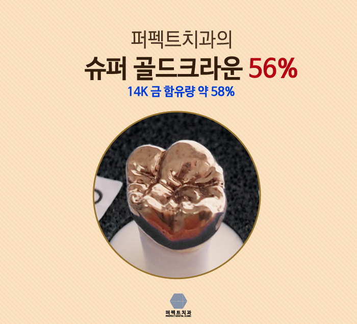 상실한 치아 찾고 싶은데 보철치료 종류에는? 관련 이미지 3