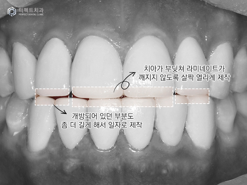 남자라미네이트, 폴리네이트 두가지 케이스 관련 이미지 7