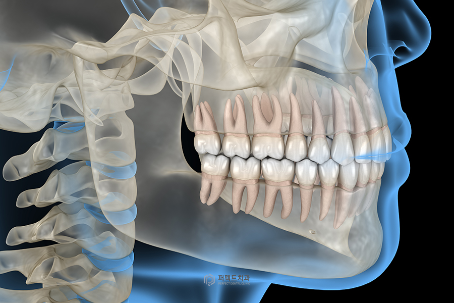 턱관절 안 좋은데 치아교정 해도 될까요? 관련 이미지 2