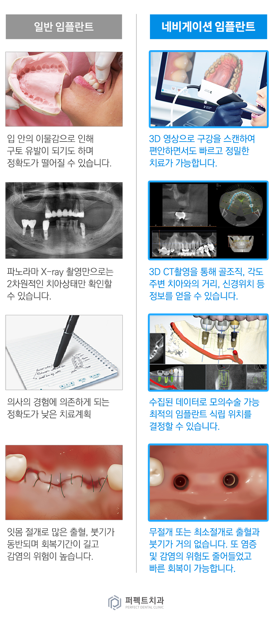 컴퓨터 분석을 통한 임플란트 관련 이미지 7