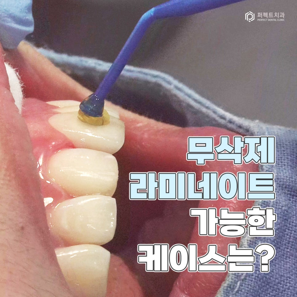 무삭제 라미네이트 추천 및 가능한 케이스 확인하기 관련 이미지 1