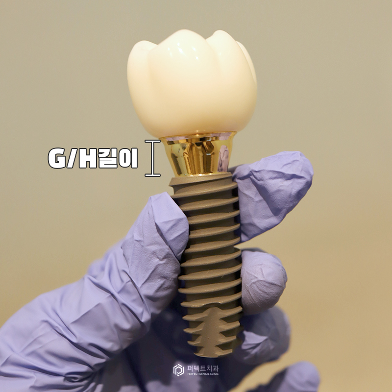 임플란트 상실로 이어질 수 있는 주위염 예방하세요! 관련 이미지 4