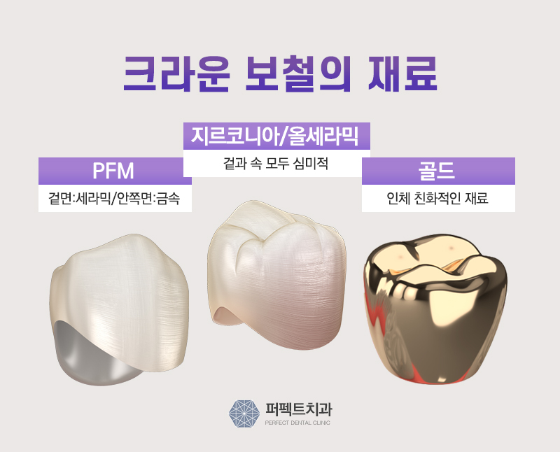선릉역 지르코니아 크라운 비용 관련 이미지 2
