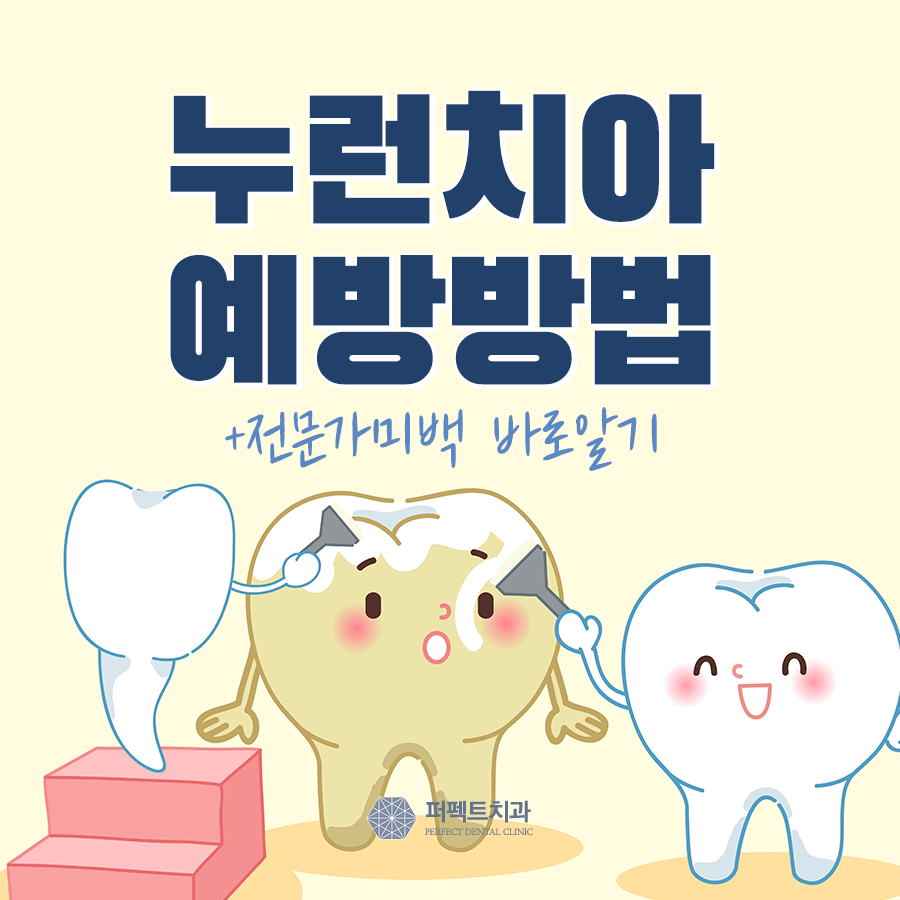 치아변색 예방방법TIP +전문가미백 바로알기 관련 이미지 1